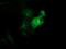 Tubulin beta-4 chain antibody, MA5-25599, Invitrogen Antibodies, Immunocytochemistry image 