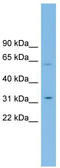 Solute Carrier Family 39 Member 9 antibody, TA333753, Origene, Western Blot image 