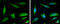 MutY DNA Glycosylase antibody, GTX103185, GeneTex, Immunofluorescence image 
