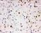 Aryl Hydrocarbon Receptor antibody, PA1782-2, Boster Biological Technology, Immunohistochemistry paraffin image 