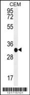 Beta-1,3-Glucuronyltransferase 3 antibody, 56-189, ProSci, Western Blot image 