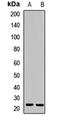 VHL Binding Protein 1 antibody, LS-C668253, Lifespan Biosciences, Western Blot image 