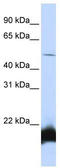 One Cut Homeobox 1 antibody, TA343466, Origene, Western Blot image 