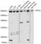 Spectrin Alpha, Erythrocytic 1 antibody, GTX64806, GeneTex, Western Blot image 