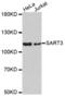 Spliceosome Associated Factor 3, U4/U6 Recycling Protein antibody, abx004566, Abbexa, Western Blot image 