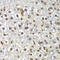 Receptor For Activated C Kinase 1 antibody, 14-968, ProSci, Immunohistochemistry paraffin image 