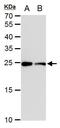 Triosephosphate Isomerase 1 antibody, MA5-18297, Invitrogen Antibodies, Western Blot image 