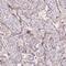 Serine/Threonine Kinase 39 antibody, NBP2-49347, Novus Biologicals, Immunohistochemistry paraffin image 