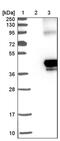 Transmembrane Protein 115 antibody, PA5-53310, Invitrogen Antibodies, Western Blot image 