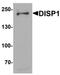 Dispatched RND Transporter Family Member 1 antibody, orb75706, Biorbyt, Western Blot image 