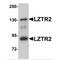 SEC16 Homolog B, Endoplasmic Reticulum Export Factor antibody, MBS150562, MyBioSource, Western Blot image 