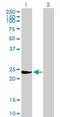 Glutathione S-Transferase Mu 3 antibody, H00002947-B02P, Novus Biologicals, Western Blot image 