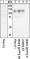 Insulin Receptor Substrate 1 antibody, GTX24882, GeneTex, Western Blot image 