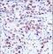 NCK Adaptor Protein 1 antibody, LS-C164773, Lifespan Biosciences, Immunohistochemistry paraffin image 