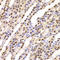 BUB3 Mitotic Checkpoint Protein antibody, LS-C334784, Lifespan Biosciences, Immunohistochemistry paraffin image 