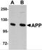 Amyloid Beta Precursor Protein antibody, 5143, ProSci Inc, Western Blot image 