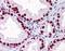 Mothers against decapentaplegic homolog 6 antibody, orb89637, Biorbyt, Immunohistochemistry paraffin image 