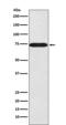 Sorting Nexin 1 antibody, M02692-1, Boster Biological Technology, Western Blot image 