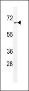 Zinc Finger Protein 169 antibody, LS-C160805, Lifespan Biosciences, Western Blot image 