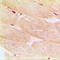 Actin Alpha 1, Skeletal Muscle antibody, LS-C351806, Lifespan Biosciences, Immunohistochemistry paraffin image 