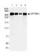 Spectrin Beta, Non-Erythrocytic 1 antibody, ab72239, Abcam, Western Blot image 