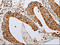 ADP Ribosylation Factor 6 antibody, CSB-PA088834, Cusabio, Immunohistochemistry paraffin image 