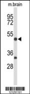 Myocyte Enhancer Factor 2A antibody, 63-859, ProSci, Western Blot image 