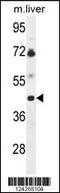 UDP-GlcNAc:BetaGal Beta-1,3-N-Acetylglucosaminyltransferase 5 antibody, 64-048, ProSci, Western Blot image 