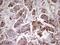 Epithelial Cell Transforming 2 antibody, MA5-26870, Invitrogen Antibodies, Immunohistochemistry paraffin image 