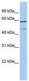 Lysosomal Associated Membrane Protein 3 antibody, TA346129, Origene, Western Blot image 