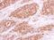 Replication Protein A1 antibody, NBP1-31382, Novus Biologicals, Immunohistochemistry frozen image 