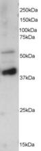 Protein Phosphatase 2 Regulatory Subunit B'Epsilon antibody, EB05231, Everest Biotech, Western Blot image 