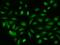 Transcriptional repressor p66-beta antibody, 206382-T02, Sino Biological, Immunohistochemistry paraffin image 