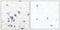 Glutamate Ionotropic Receptor AMPA Type Subunit 2 antibody, LS-C118463, Lifespan Biosciences, Immunohistochemistry paraffin image 