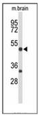 Myocyte Enhancer Factor 2A antibody, AP52661PU-N, Origene, Western Blot image 