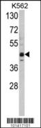 Lysine Methyltransferase 5A antibody, 56-116, ProSci, Western Blot image 