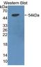 Lipoprotein Lipase antibody, LS-B15019, Lifespan Biosciences, Western Blot image 