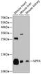 Natriuretic Peptide A antibody, 14-171, ProSci, Western Blot image 