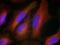 Synaptotagmin 1 antibody, 79-609, ProSci, Immunofluorescence image 