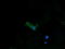 Protein Disulfide Isomerase Family A Member 3 antibody, M01464-2, Boster Biological Technology, Immunofluorescence image 