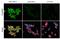 Androgen Receptor antibody, GTX636639, GeneTex, Immunofluorescence image 