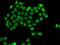 PHD Finger Protein 11 antibody, PA5-76271, Invitrogen Antibodies, Immunofluorescence image 