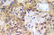 Serine/threonine-protein kinase Chk2 antibody, AP21019PU-N, Origene, Immunohistochemistry frozen image 
