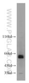 Acyl-CoA Binding Domain Containing 5 antibody, 21080-1-AP, Proteintech Group, Western Blot image 