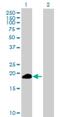 Zinc Finger And SCAN Domain Containing 1 antibody, H00284312-B01P, Novus Biologicals, Western Blot image 