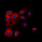 BCL2L2-PABPN1 Readthrough antibody, LS-C353907, Lifespan Biosciences, Immunofluorescence image 