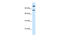 Sterol Regulatory Element Binding Transcription Factor 2 antibody, 31-080, ProSci, Western Blot image 