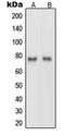 Netrin 1 antibody, LS-C353167, Lifespan Biosciences, Western Blot image 
