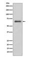 Interleukin 1 Receptor Associated Kinase 3 antibody, M02469, Boster Biological Technology, Western Blot image 