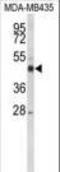 Cytochrome P450 Family 21 Subfamily A Member 2 antibody, LS-B12176, Lifespan Biosciences, Western Blot image 